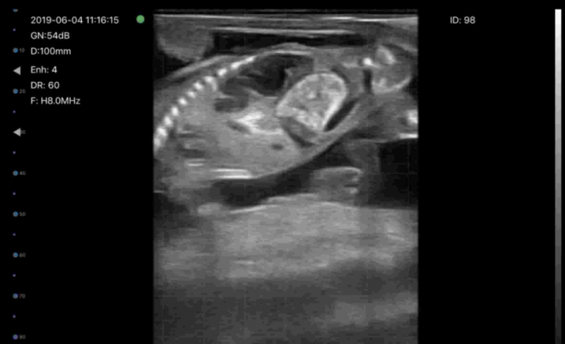 Introduction into bovine ultrasonography